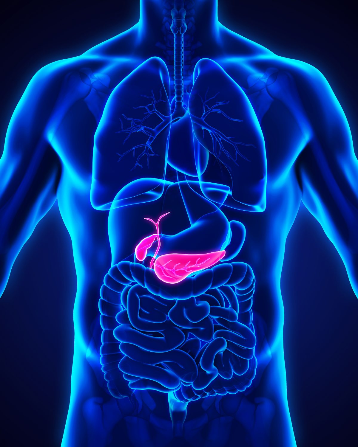 cirug-a-de-hernia-inguinal-dr-germ-n-castelazo-ram-rez